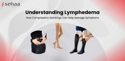 Understanding Lymphedema: How Compression Stockings Can Help Manage Symptoms